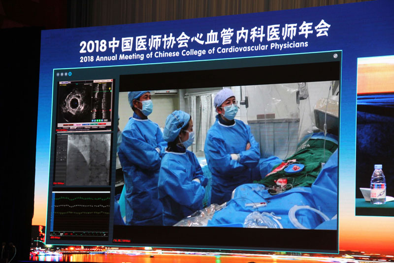 轻舟药物球囊羊城收获赞誉 6年与30秒展现中国力量与中国自信(图3) 轻舟药物球囊羊城收获赞誉 6年与30秒展现中国力量与中国自信(图3)